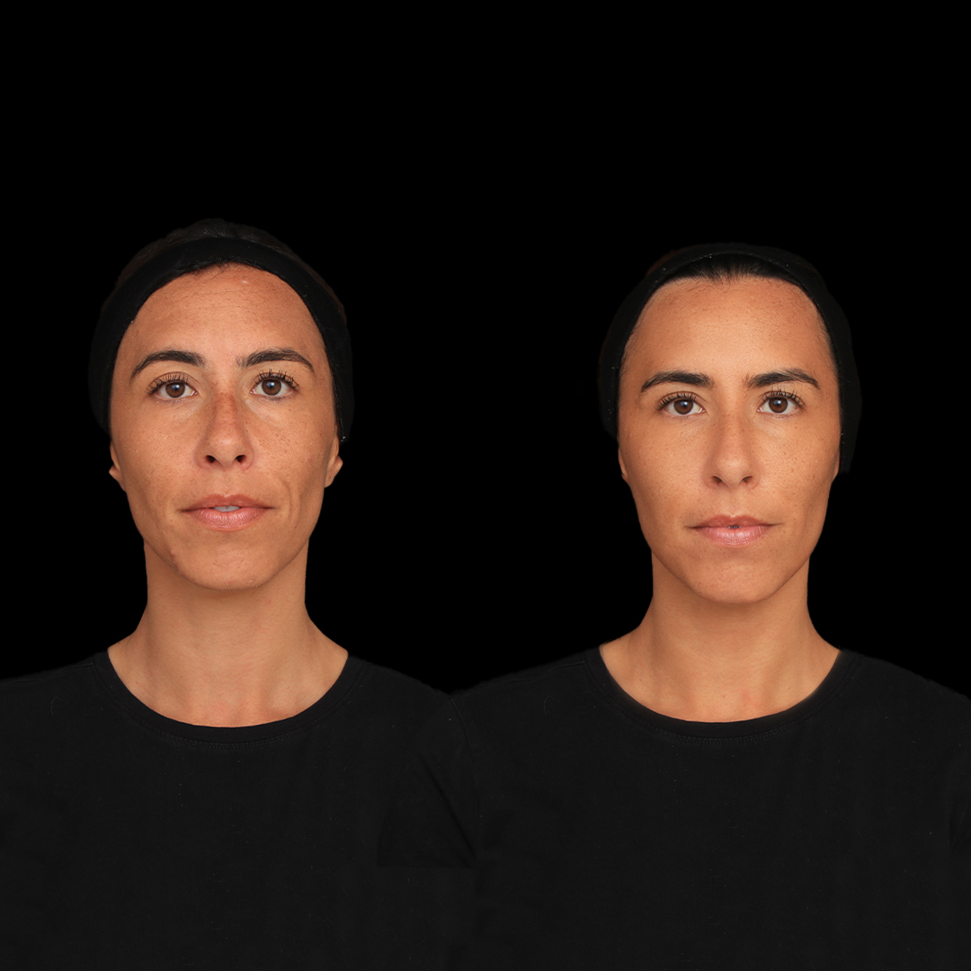 5 - Raquel Lopes - RA editado